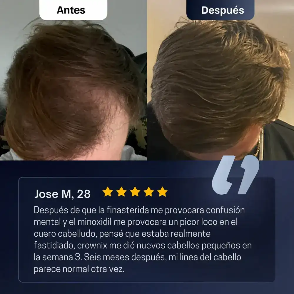 Serum Roll-On de Crecimiento Capilar (Formula Mejorada)