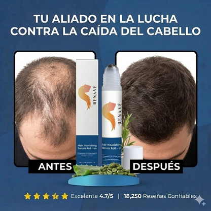 Serum Roll-On de Crecimiento Capilar (Formula Mejorada)