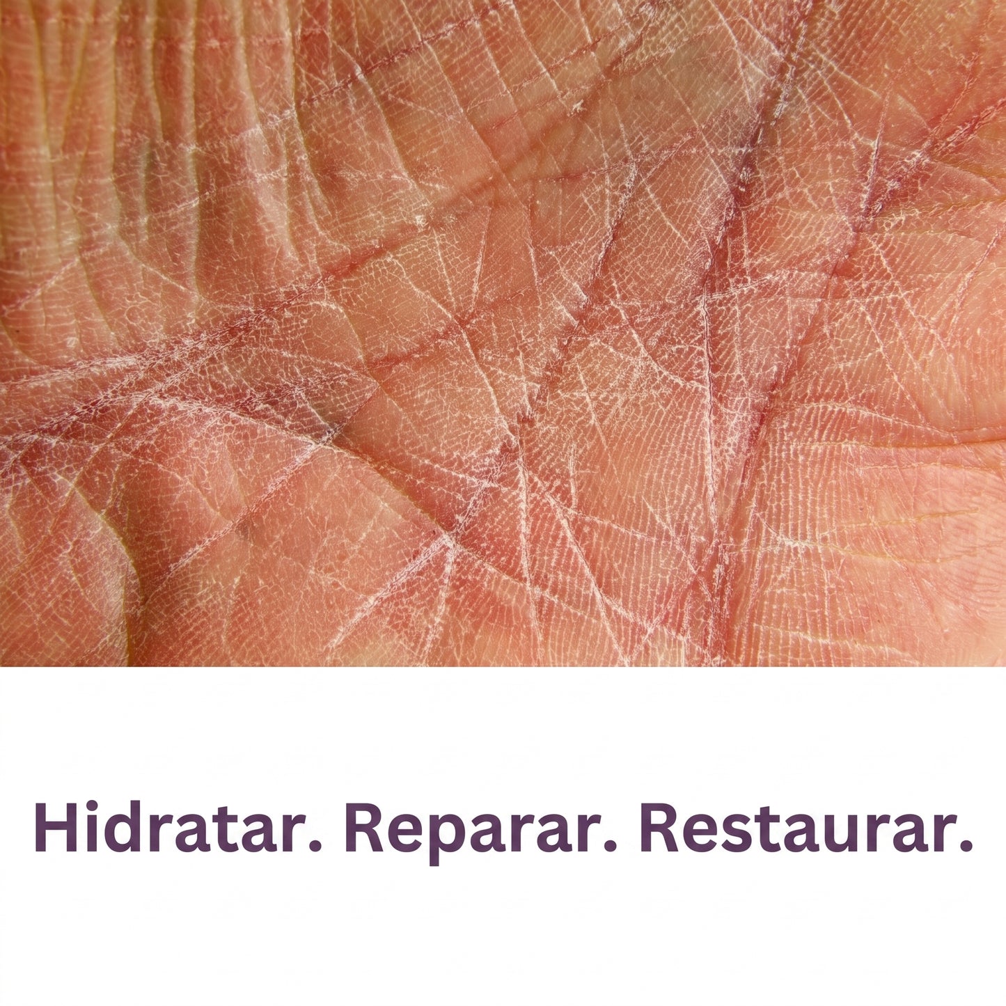 Scar Cream Drs. Pharmacy
