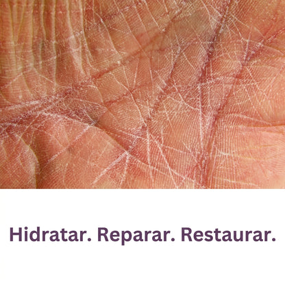 Scar Cream Drs. Pharmacy