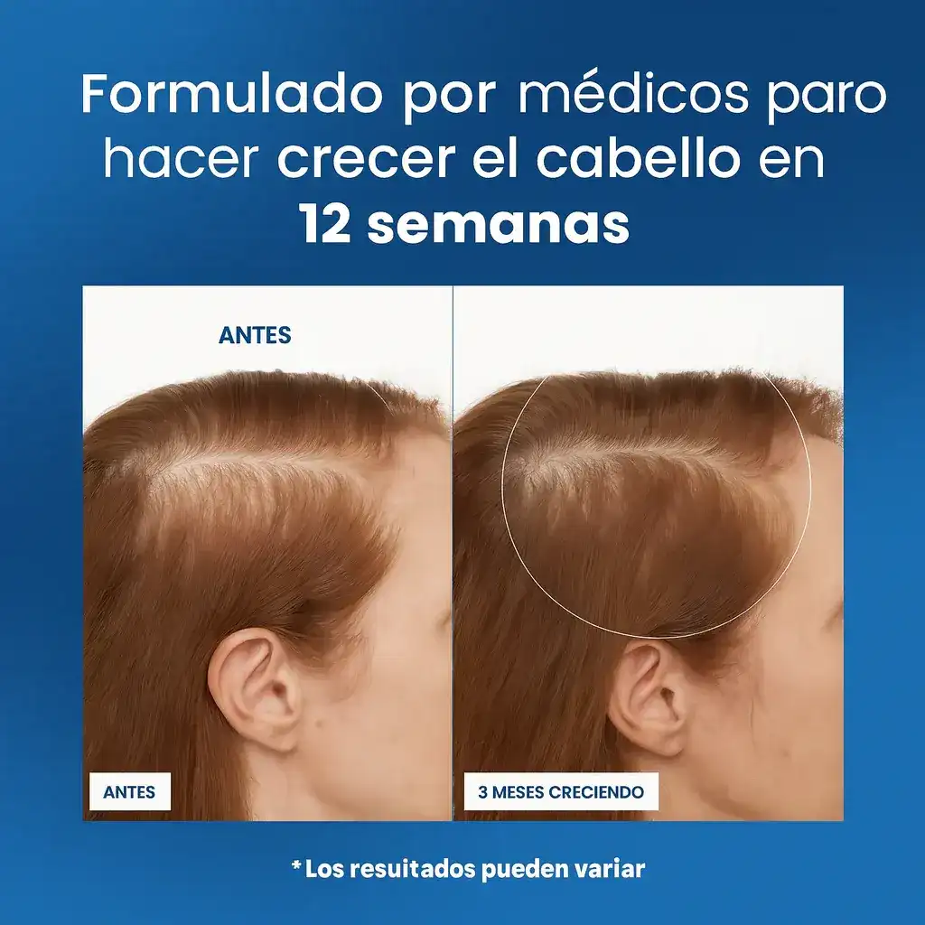 Serum Roll-On de Crecimiento Capilar